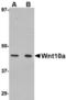 Protein Wnt-10a antibody, TA306591, Origene, Western Blot image 
