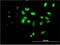 Forkhead box protein F2 antibody, H00002295-M03, Novus Biologicals, Immunofluorescence image 