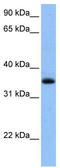 Chimerin 2 antibody, TA339979, Origene, Western Blot image 