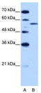 Zinc Finger CCCH-Type, RNA Binding Motif And Serine/Arginine Rich 2 antibody, TA345908, Origene, Western Blot image 
