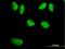 WRN RecQ Like Helicase antibody, H00007486-M09, Novus Biologicals, Immunocytochemistry image 