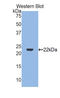 Interferon Gamma antibody, LS-C294755, Lifespan Biosciences, Western Blot image 
