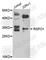 R-Spondin 1 antibody, A8289, ABclonal Technology, Western Blot image 