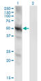 Protein Phosphatase 3 Catalytic Subunit Gamma antibody, LS-C197974, Lifespan Biosciences, Western Blot image 