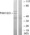 Serine/threonine-protein kinase PAK 1 antibody, PA5-38310, Invitrogen Antibodies, Western Blot image 
