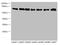 NUMB Endocytic Adaptor Protein antibody, LS-C676200, Lifespan Biosciences, Western Blot image 