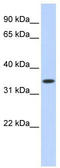 Zinc finger protein RFP antibody, TA337296, Origene, Western Blot image 