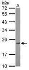 Casein kinase II subunit beta antibody, NBP2-21570, Novus Biologicals, Western Blot image 