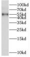 Plasma protease C1 inhibitor antibody, FNab07753, FineTest, Western Blot image 