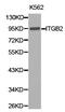 Integrin Subunit Beta 2 antibody, LS-C193090, Lifespan Biosciences, Western Blot image 