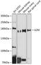 Alpha-2-Macroglobulin antibody, GTX32434, GeneTex, Western Blot image 