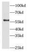 ETS translocation variant 5 antibody, FNab02881, FineTest, Western Blot image 