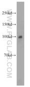 2'-5'-Oligoadenylate Synthetase 3 antibody, 21915-1-AP, Proteintech Group, Western Blot image 