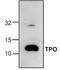 Thrombopoietin antibody, TA319079, Origene, Western Blot image 