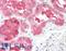Succinate Dehydrogenase Complex Subunit D antibody, LS-B8827, Lifespan Biosciences, Immunohistochemistry paraffin image 