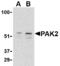 P21 (RAC1) Activated Kinase 2 antibody, TA306345, Origene, Western Blot image 
