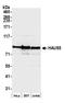 HAUS Augmin Like Complex Subunit 5 antibody, A305-827A-M, Bethyl Labs, Western Blot image 