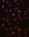 Glutathione S-Transferase Theta 1 antibody, GTX55652, GeneTex, Immunocytochemistry image 