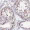 Zinc Finger Protein 778 antibody, PA5-63406, Invitrogen Antibodies, Immunohistochemistry frozen image 