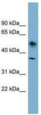 ATPase Na+/K+ Transporting Subunit Beta 1 antibody, TA335283, Origene, Western Blot image 