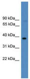 Fos-related antigen 2 antibody, TA329235, Origene, Western Blot image 