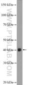 Ankyrin Repeat And SOCS Box Containing 5 antibody, 24031-1-AP, Proteintech Group, Western Blot image 