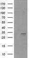 Retinoic Acid Receptor Responder 1 antibody, CF506085, Origene, Western Blot image 