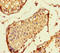 Kinetochore protein Spc24 antibody, LS-C679603, Lifespan Biosciences, Immunohistochemistry paraffin image 