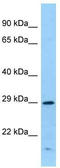 Interferon gamma receptor 1 antibody, TA343330, Origene, Western Blot image 