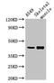 Protein Phosphatase, Mg2+/Mn2+ Dependent 1K antibody, LS-C399461, Lifespan Biosciences, Western Blot image 