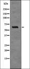 Epidermal growth factor receptor kinase substrate 8 antibody, orb337255, Biorbyt, Western Blot image 