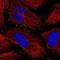 Fibroblast growth factor receptor 2 antibody, NBP1-88670, Novus Biologicals, Immunocytochemistry image 
