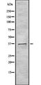 Taste 2 Receptor Member 40 antibody, orb336453, Biorbyt, Western Blot image 