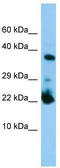 Mono-ADP Ribosylhydrolase 2 antibody, TA334322, Origene, Western Blot image 