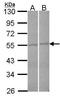 F-Box And Leucine Rich Repeat Protein 2 antibody, PA5-28140, Invitrogen Antibodies, Western Blot image 