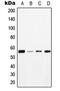 Microtubule Associated Protein Tau antibody, MBS821077, MyBioSource, Western Blot image 