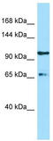 ESF1 Nucleolar Pre-RRNA Processing Protein Homolog antibody, TA331250, Origene, Western Blot image 