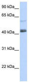 PR/SET Domain 15 antibody, TA341457, Origene, Western Blot image 