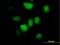 Zinc Finger Protein 74 antibody, H00007625-B01P, Novus Biologicals, Immunofluorescence image 