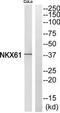 Homeobox protein Nkx-6.1 antibody, TA312303, Origene, Western Blot image 