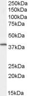 FXYD Domain Containing Ion Transport Regulator 5 antibody, 45-510, ProSci, Western Blot image 