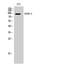 Fibroblast Growth Factor Receptor 3 antibody, STJ93066, St John