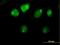 Zinc Finger And BTB Domain Containing 26 antibody, H00057684-B01P, Novus Biologicals, Immunofluorescence image 