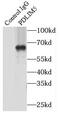 PDZ and LIM domain protein 5 antibody, FNab06284, FineTest, Immunoprecipitation image 