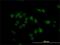 CaRF antibody, H00055602-M02, Novus Biologicals, Immunocytochemistry image 