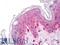 Plectin antibody, LS-B8172, Lifespan Biosciences, Immunohistochemistry frozen image 