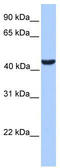 Abhydrolase Domain Containing 5 antibody, TA344120, Origene, Western Blot image 