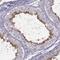 Radial Spoke Head 6 Homolog A antibody, NBP1-92356, Novus Biologicals, Immunohistochemistry paraffin image 