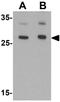 Androgen Induced 1 antibody, GTX17168, GeneTex, Western Blot image 