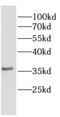 Cone-Rod Homeobox antibody, FNab01999, FineTest, Western Blot image 